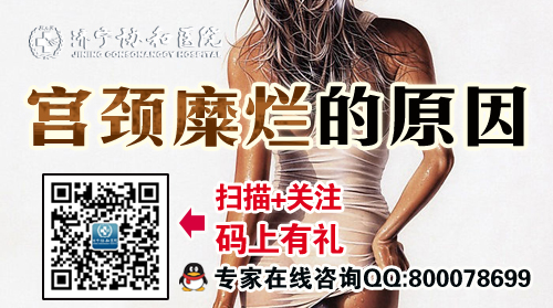 济宁宫颈糜烂